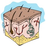 Skin Cutaway clip art link thumbnail